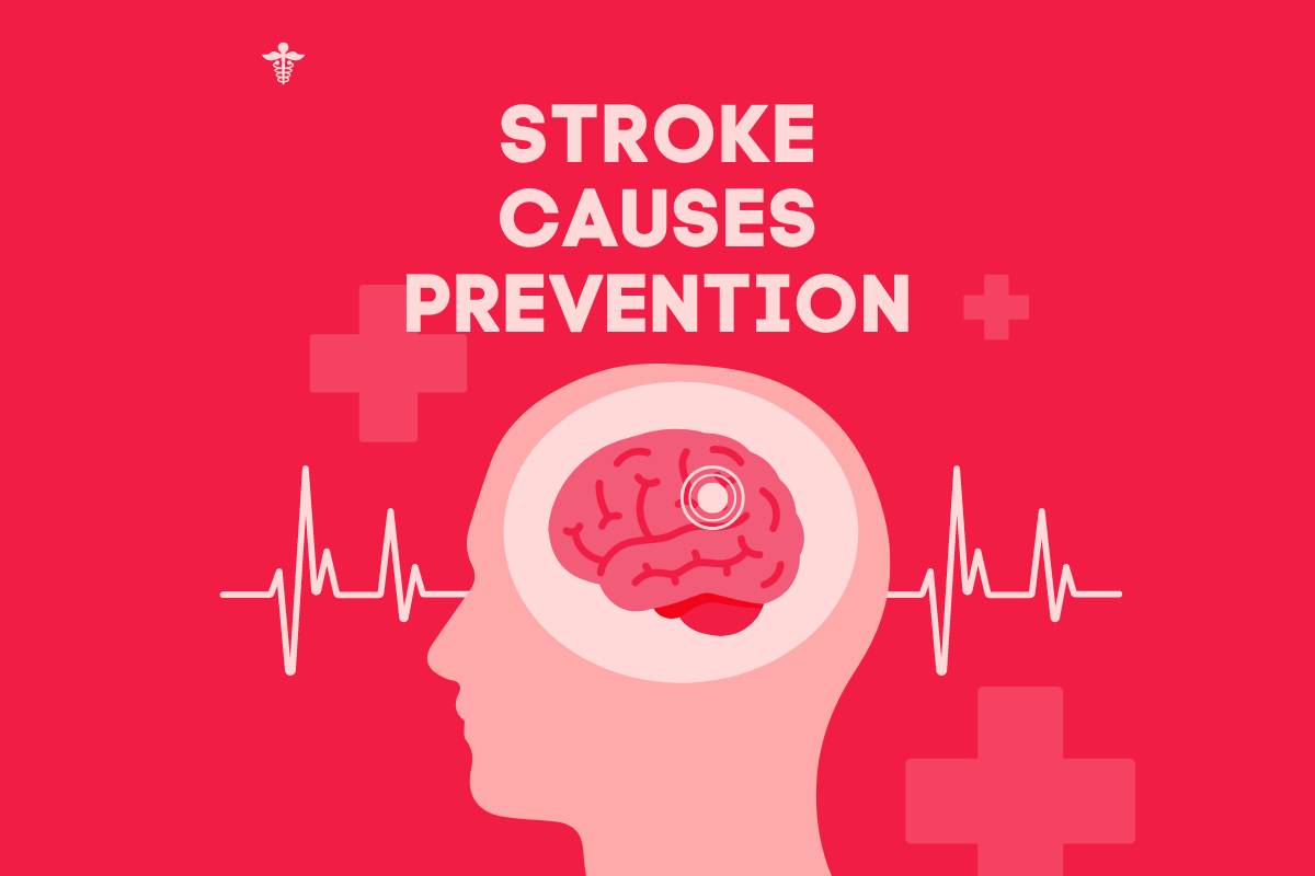 Stroke Causes, Prevention